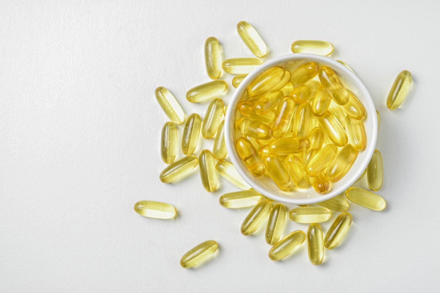 Assortment of anti-inflammatory foods including turmeric root, berries, olive oil, and fatty fish arranged for joint health