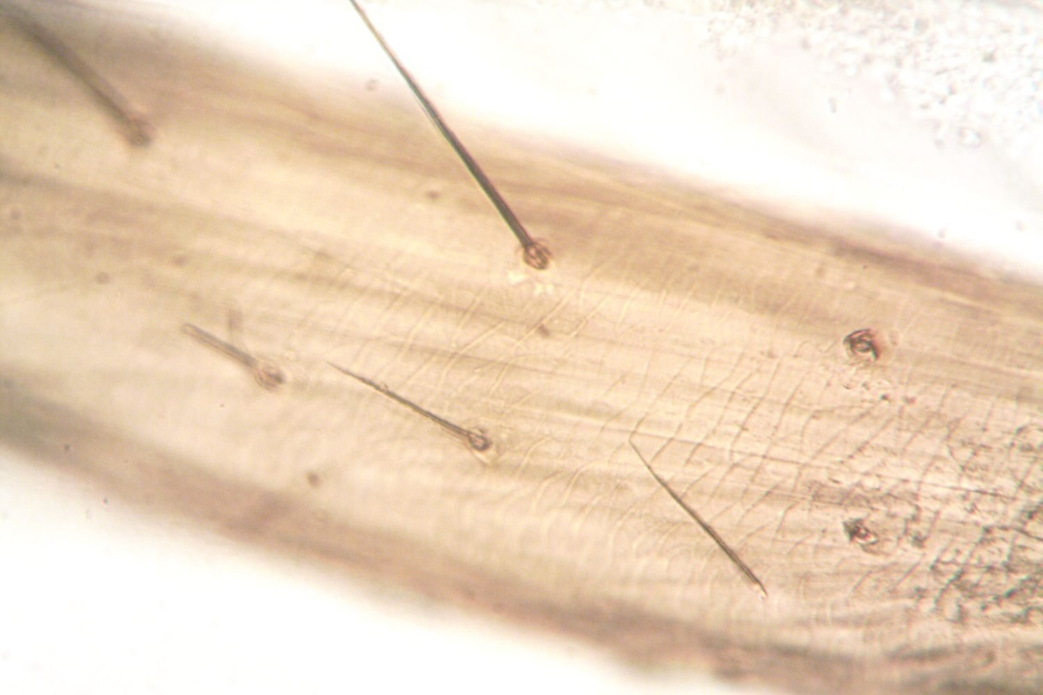 Close-up cross-section diagram of a hair strand showing the cuticle, cortex, and medulla layers made of keratin protein