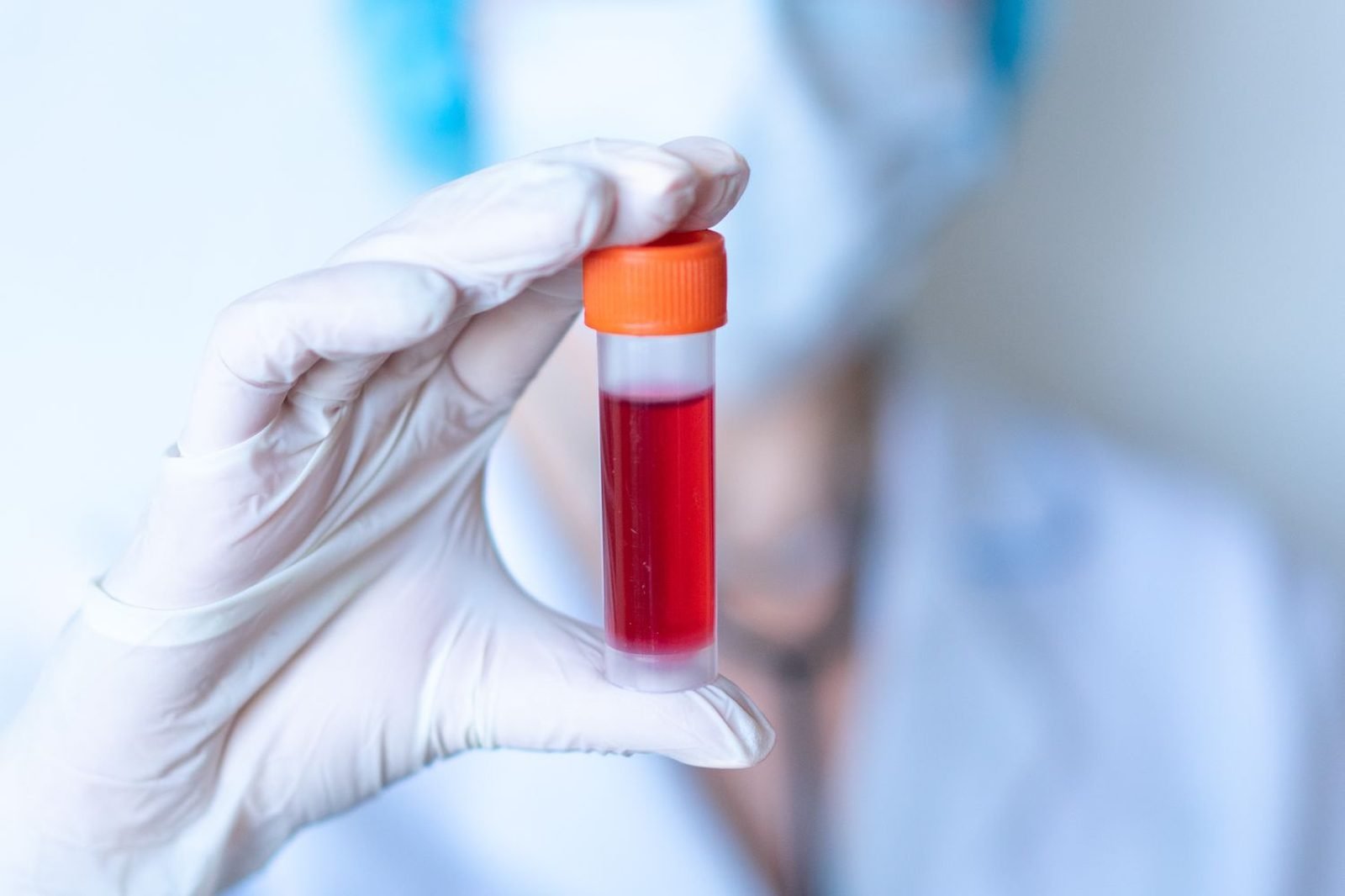 Doctor drawing blood sample for a nutritional deficiency test in a clinic