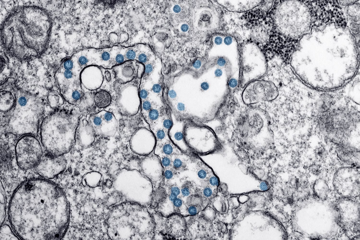 Illustration of immune cells and trace minerals like iron and zinc at the host-pathogen interface