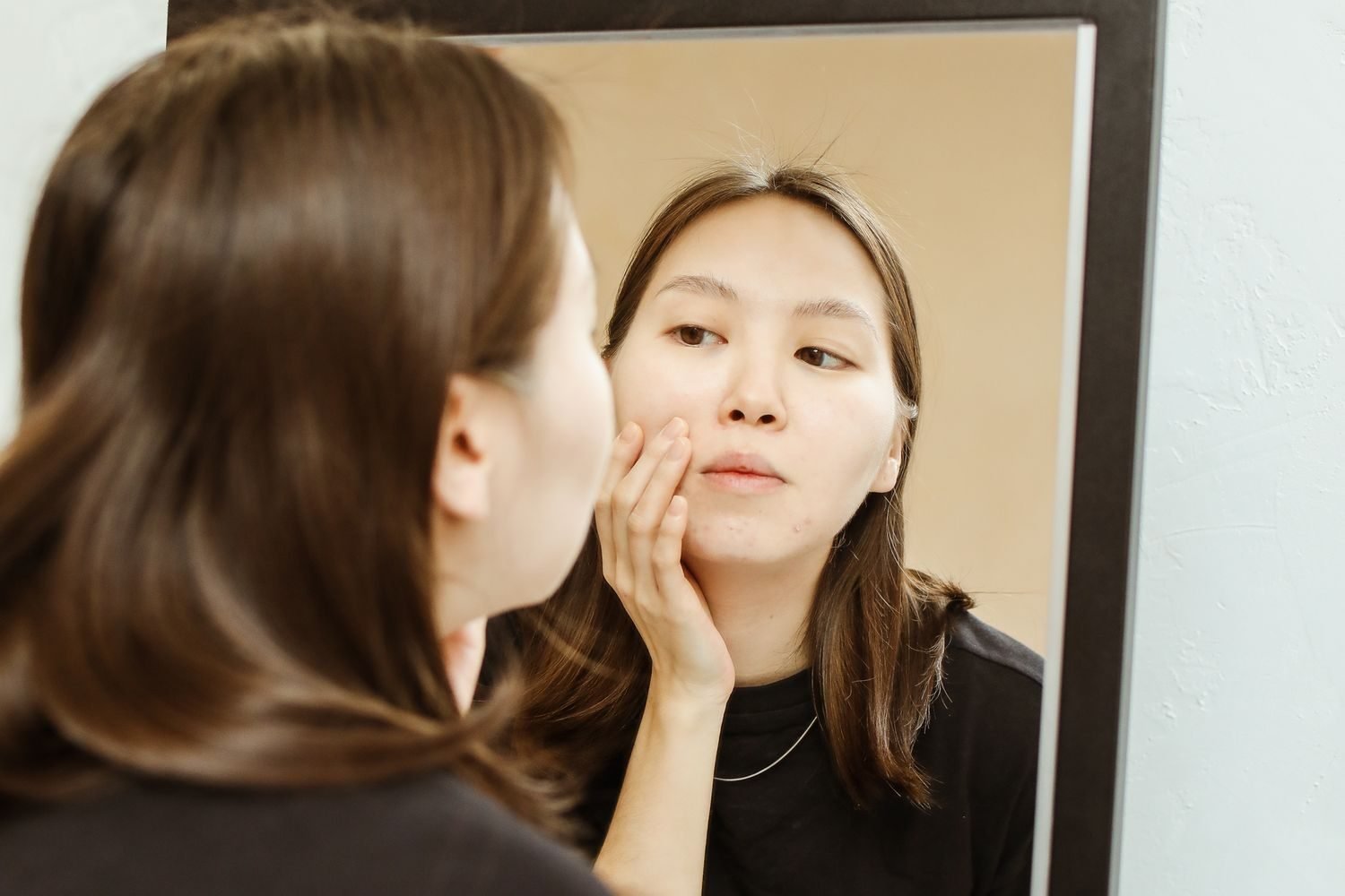 Close-up of a person examining their skin in a mirror, checking for breakouts possibly linked to high sugar intake